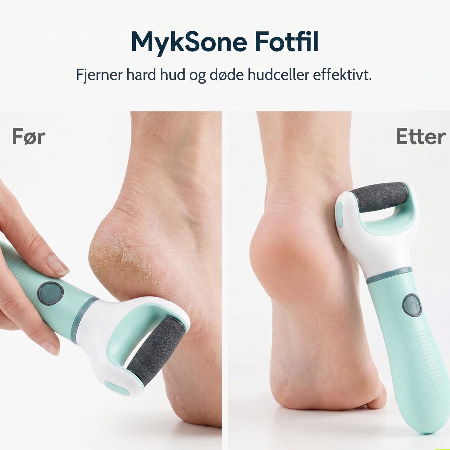 MykSone Fotfil™
